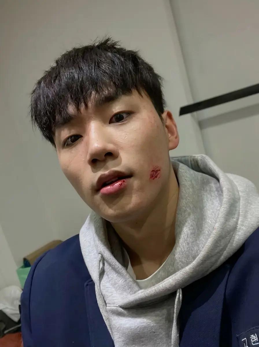 Go Hyuntak (Gotak) thumbnail