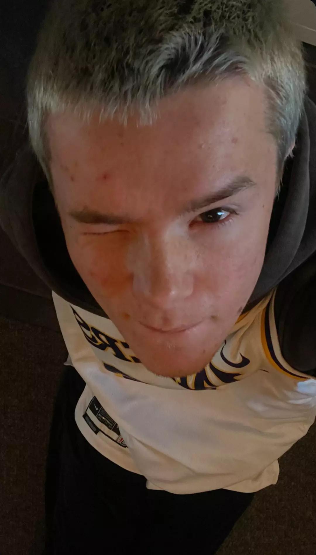 Edvin Ryding  thumbnail