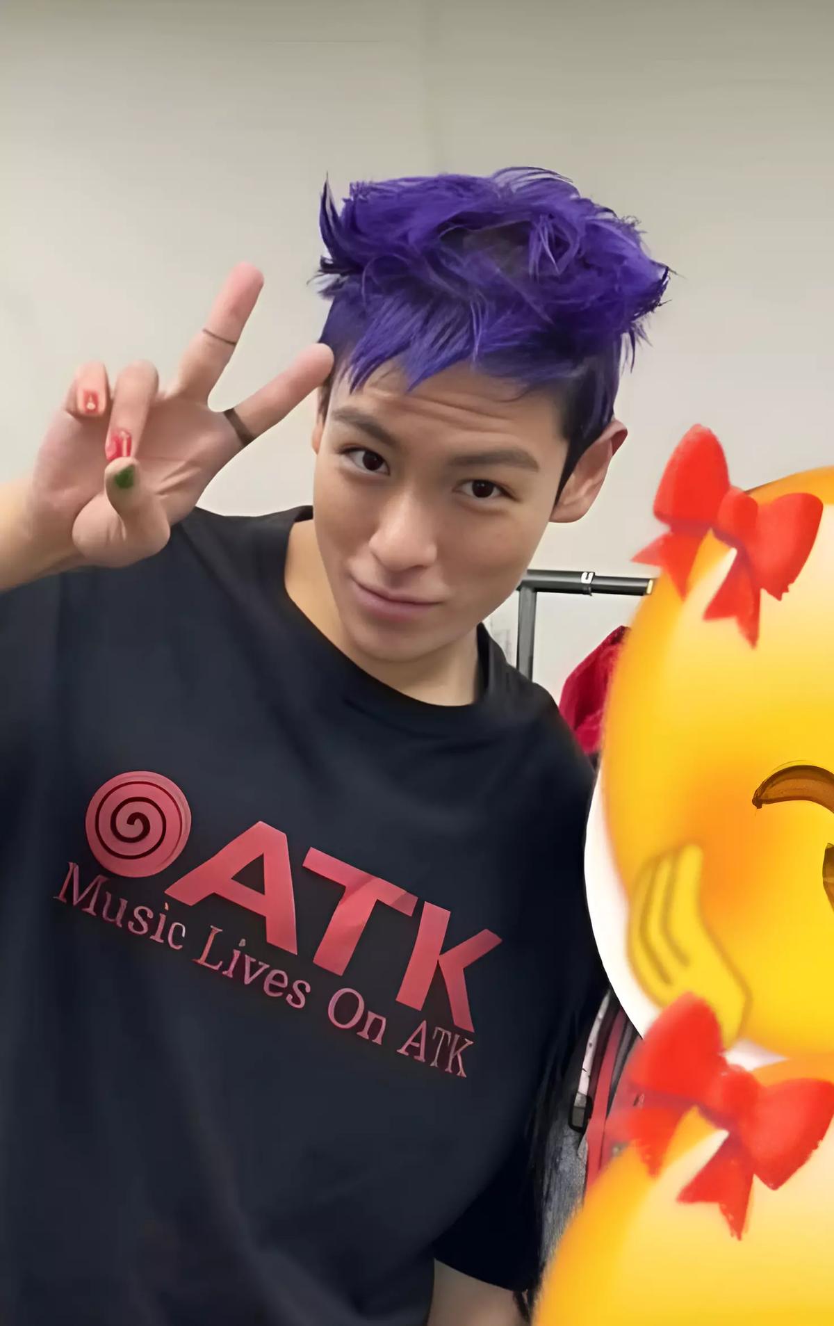 T.O.P (Choi Seung-hyun) thumbnail