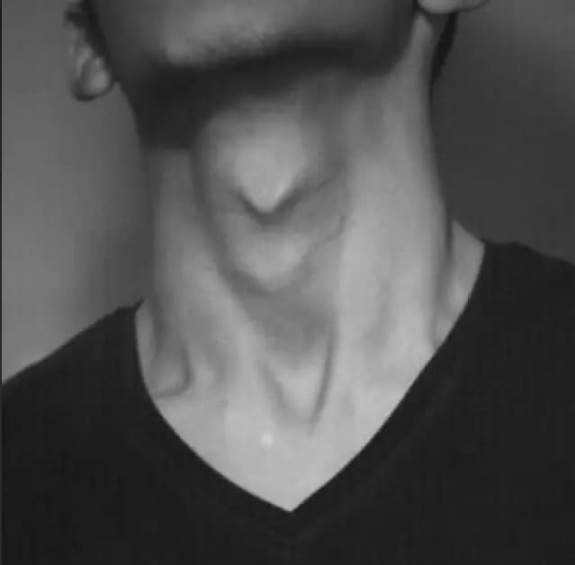 -         -  thumbnail