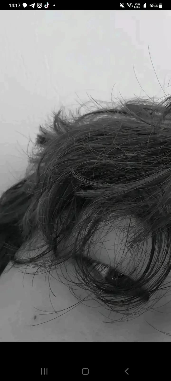 Serve thumbnail