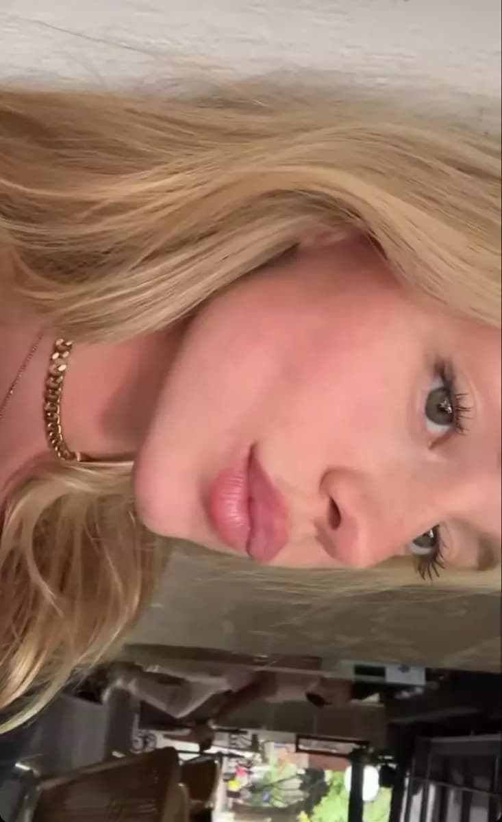 Ester exposed thumbnail