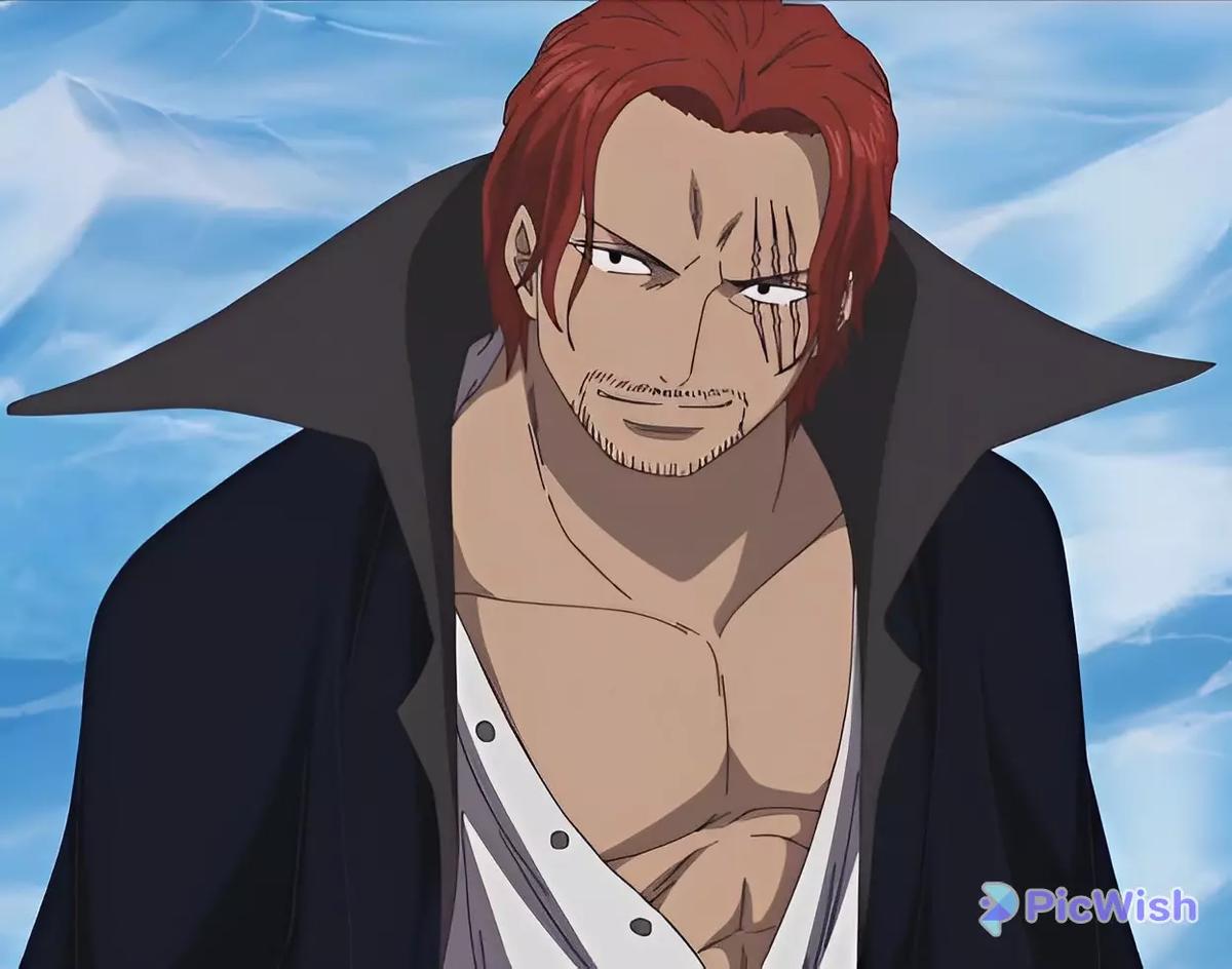 Shanks thumbnail