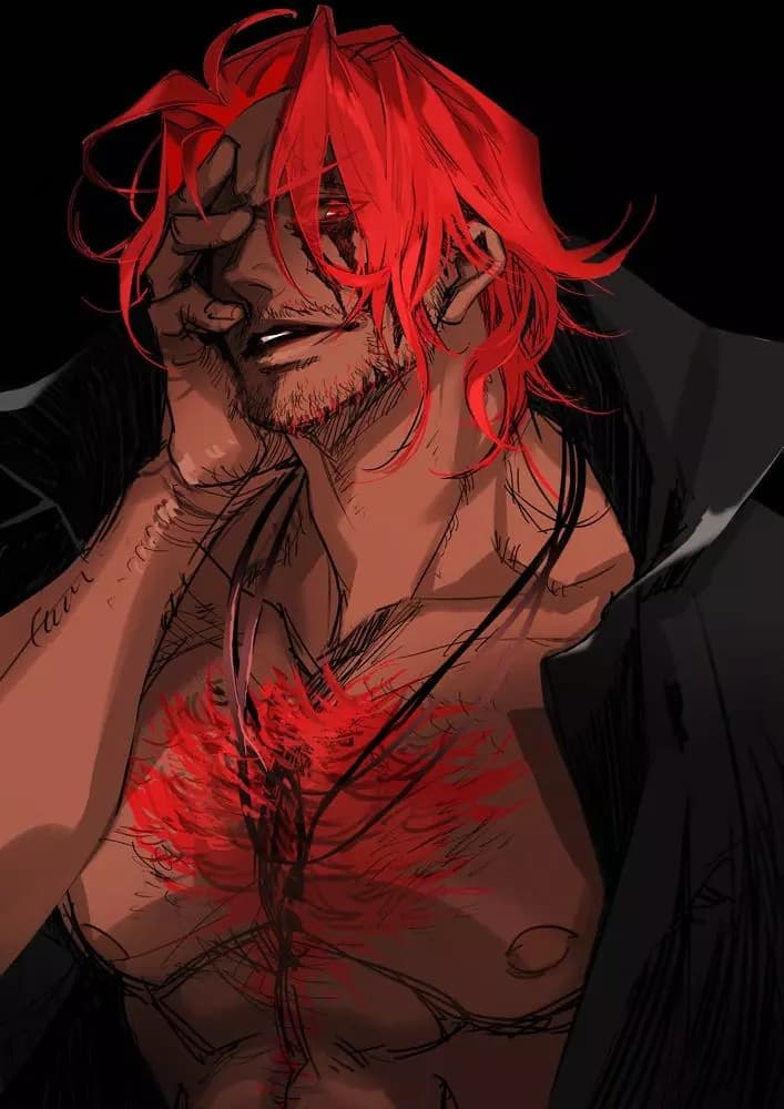 Shanks thumbnail