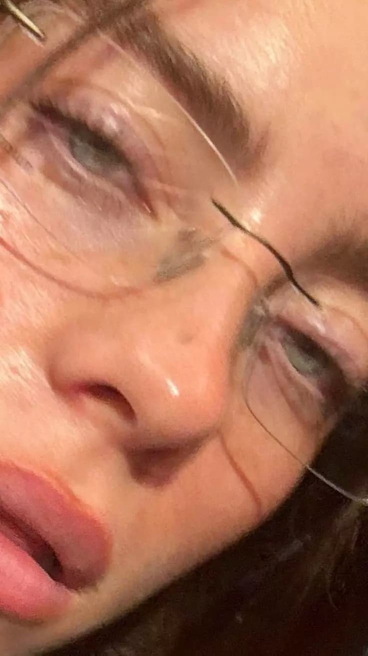 Billie Eilish  thumbnail