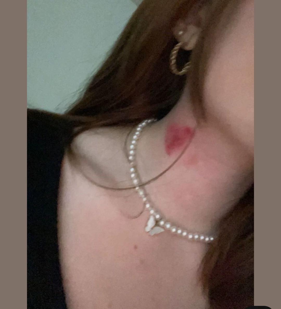 Hickey prank on boyfriend  thumbnail