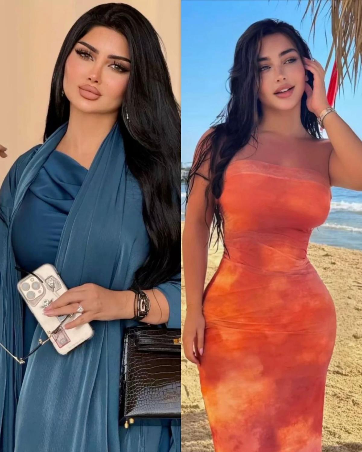 Mirena and eirena  thumbnail