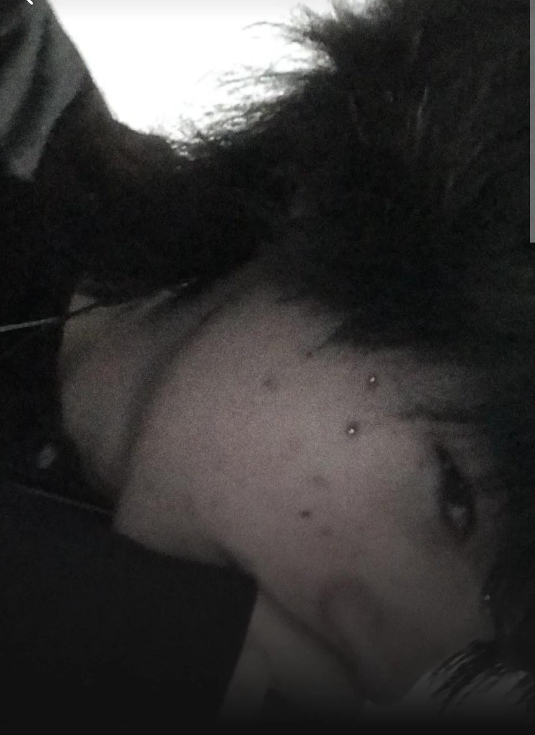Axel thumbnail