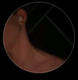Kristjan Ojaste thumbnail
