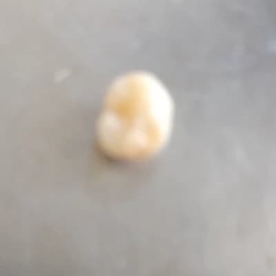 Tooth thumbnail