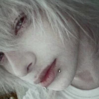 Ian - Albino classmate thumbnail