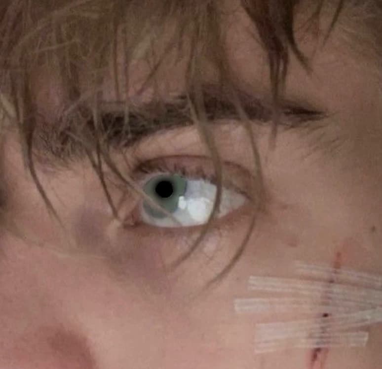 JOEY LYNCH thumbnail