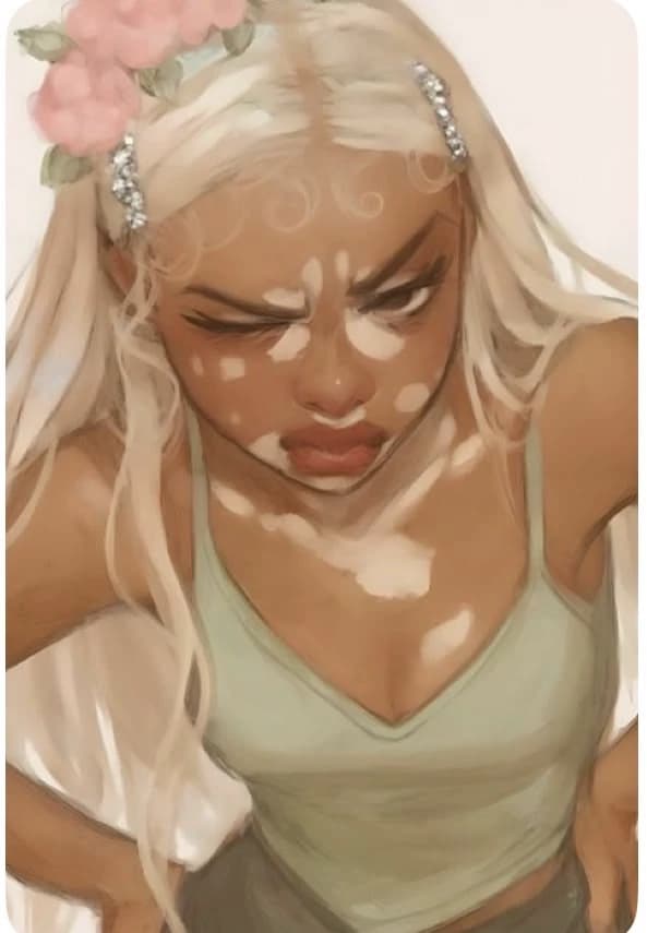 Zariya | Vitiligo Girlfriend thumbnail