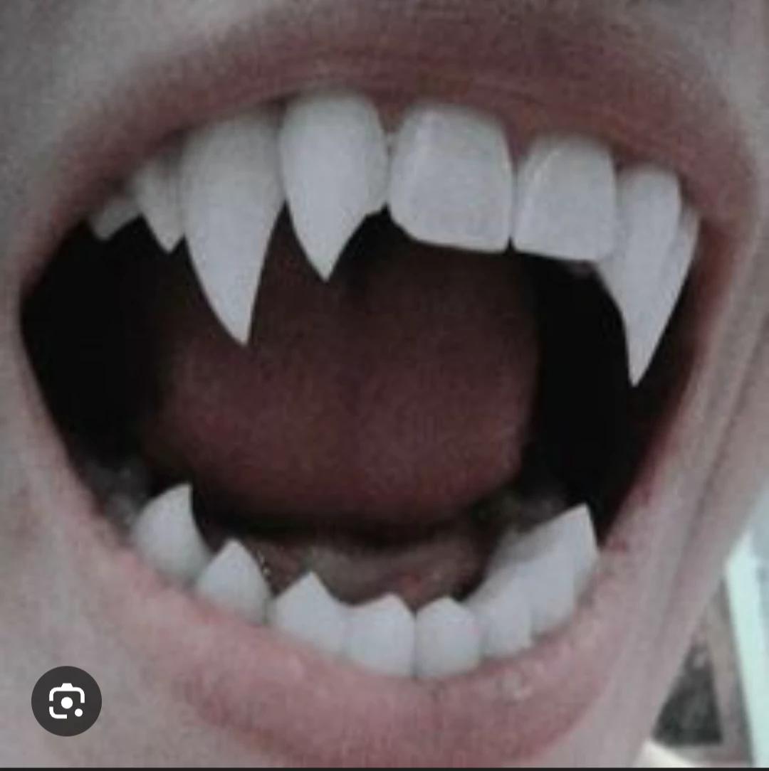 Werewolf × Vampire thumbnail