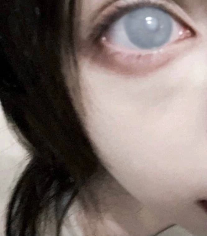 1 - Blind Husband thumbnail
