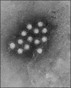RP Diseases thumbnail