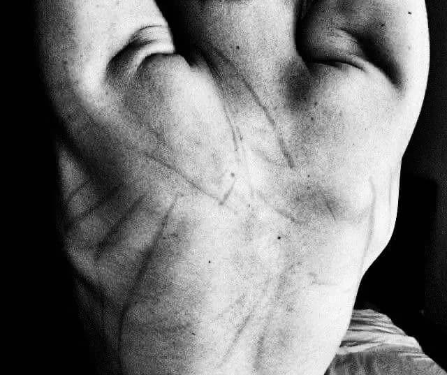 Psych patient thumbnail