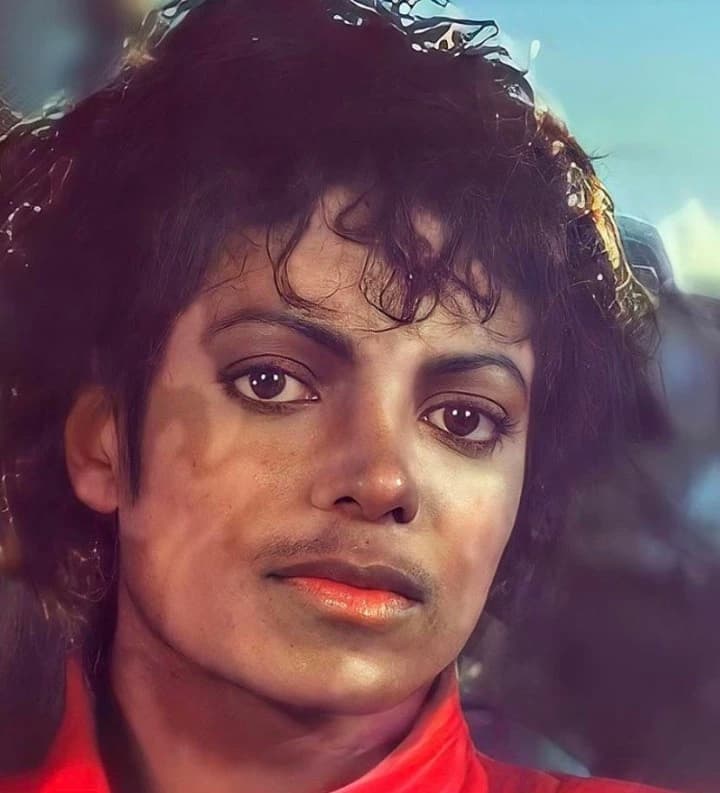 Michael Jackson (vitiligo) thumbnail