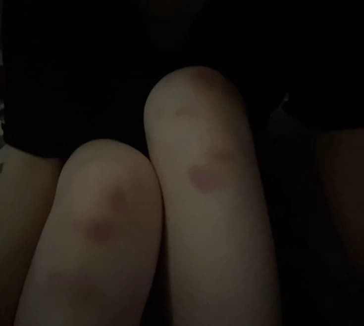 Tillin (BL)  thumbnail