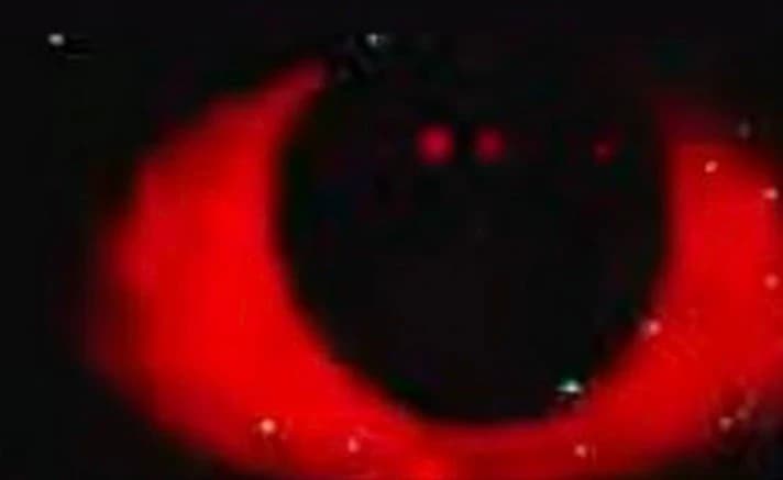 Nightmare  thumbnail