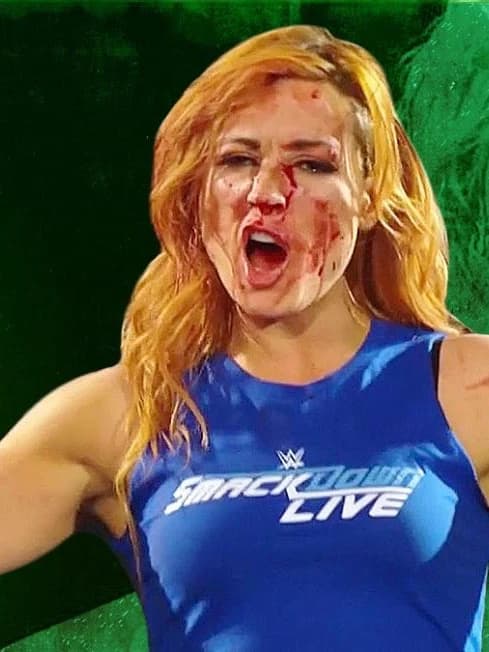Becky Lynch thumbnail