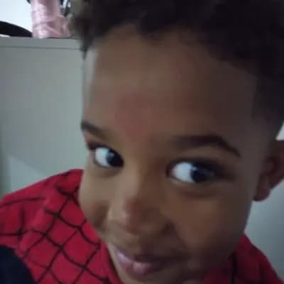 Gerson thumbnail