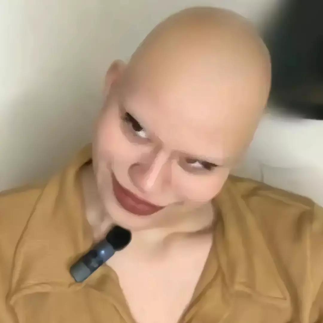 bald mother thumbnail