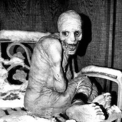 Russian Sleep Experiment Patient thumbnail