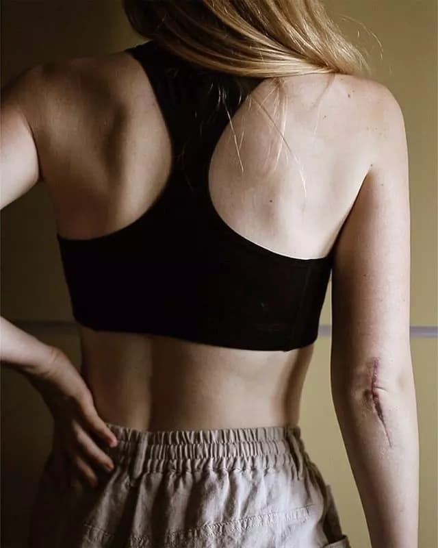Abby Anderson thumbnail