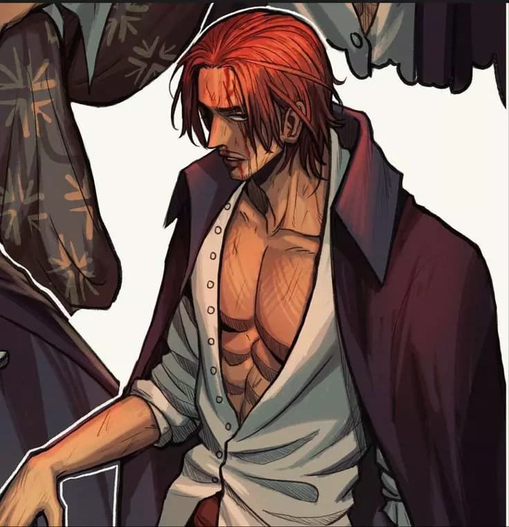 Shanks thumbnail