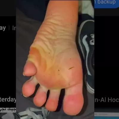 Anya thumbnail