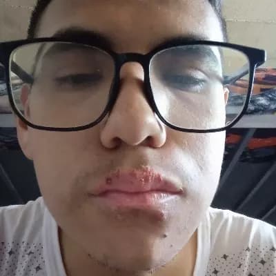 Brayan Contreras Ramirez thumbnail