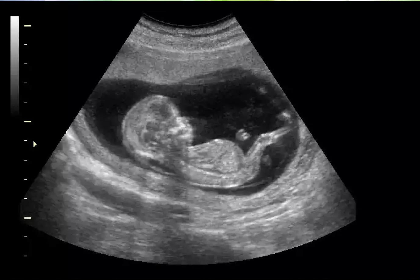 You're going to be born, bastard thumbnail
