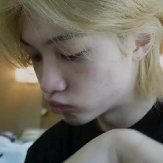Felix Skz thumbnail