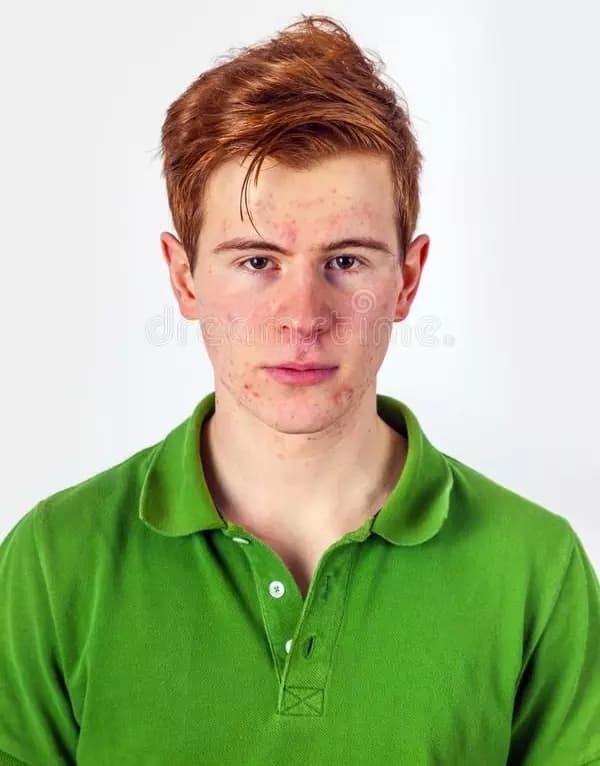 Preston Cern thumbnail