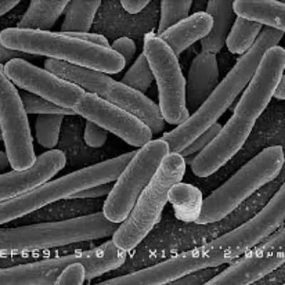 E. Coli  thumbnail