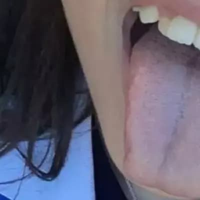 Over the thumbnail