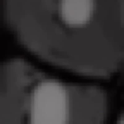 Laurie Minole thumbnail