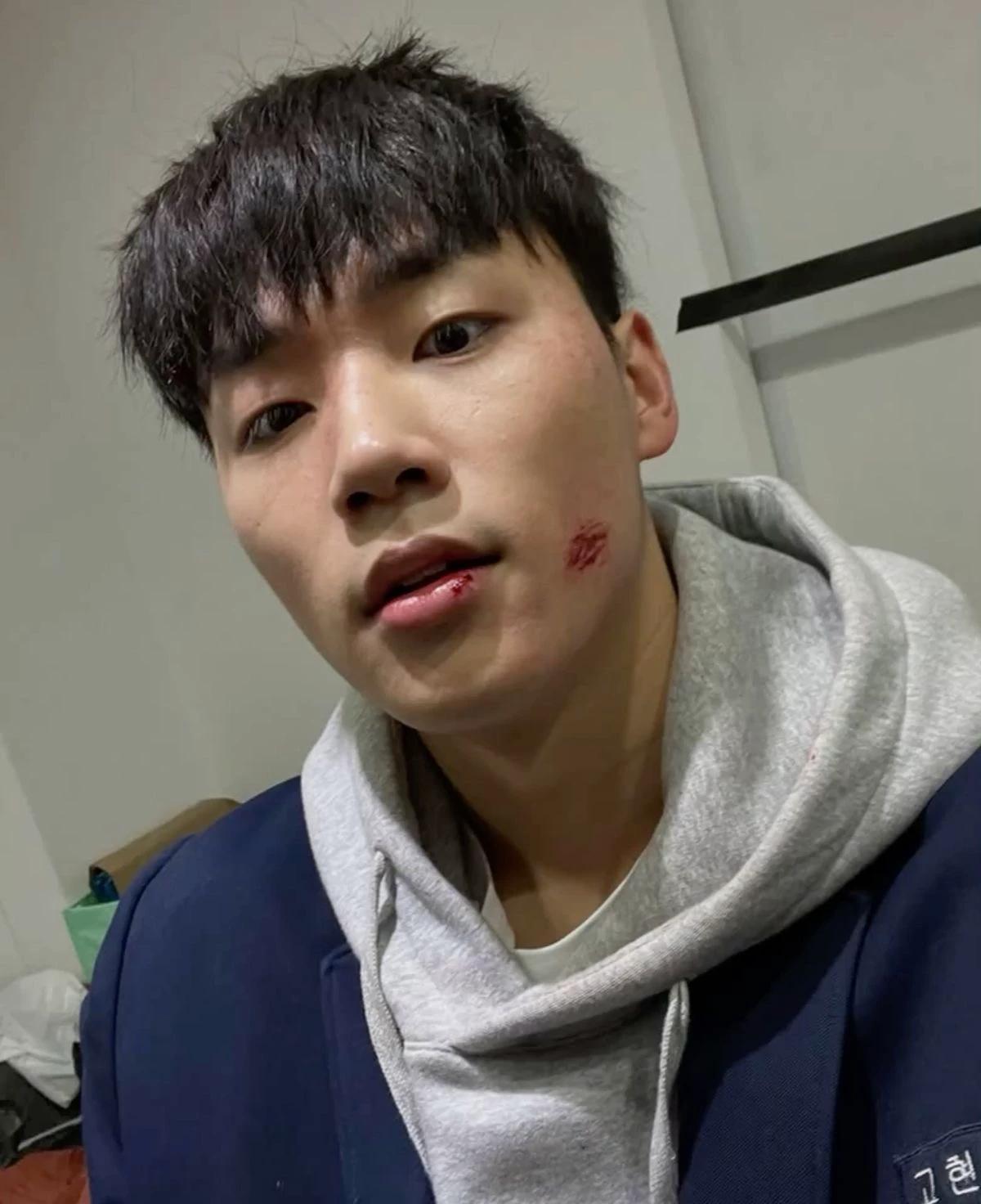 Go Hyuntak (Gotak) thumbnail