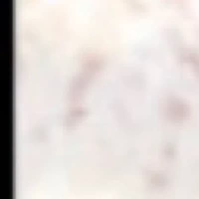 Mel thumbnail