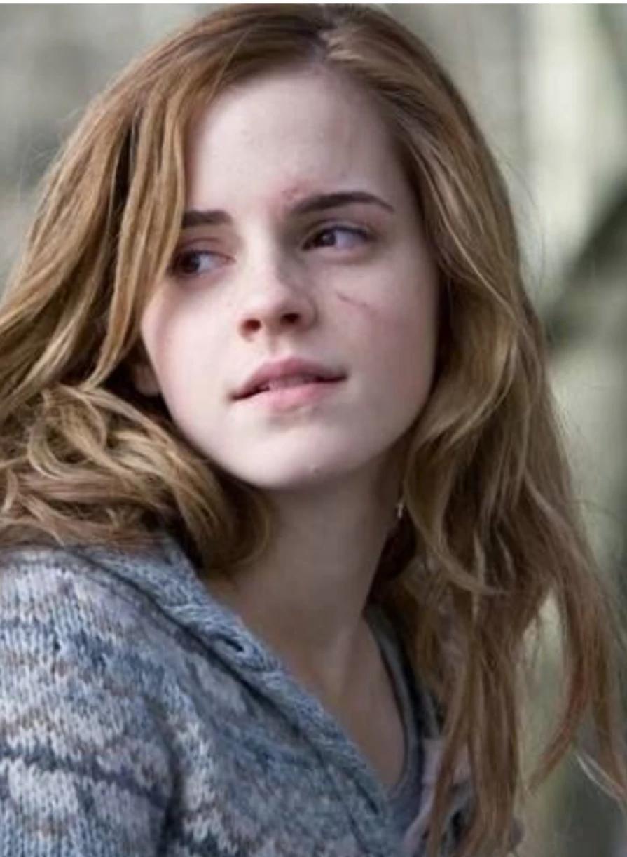 Hermione  thumbnail