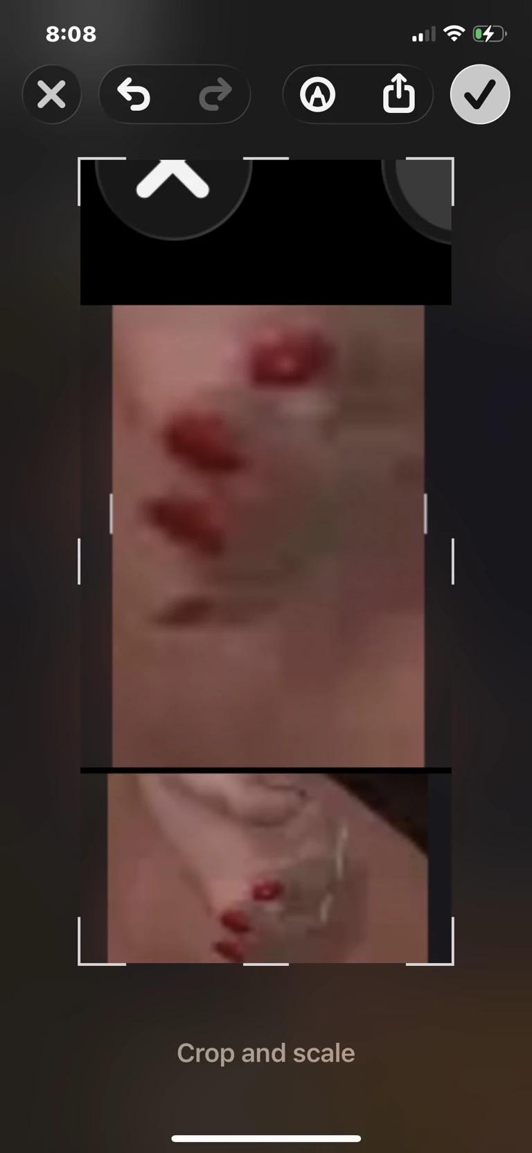 Fingers scrub thumbnail