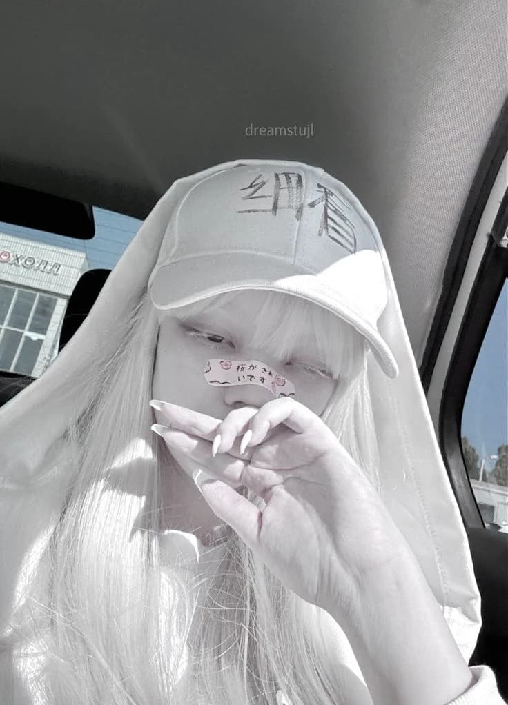 Olga - his albino wife thumbnail