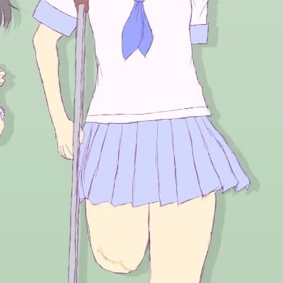 Anya (amputee) thumbnail