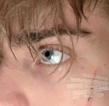 Alexander (Alex) - BL thumbnail