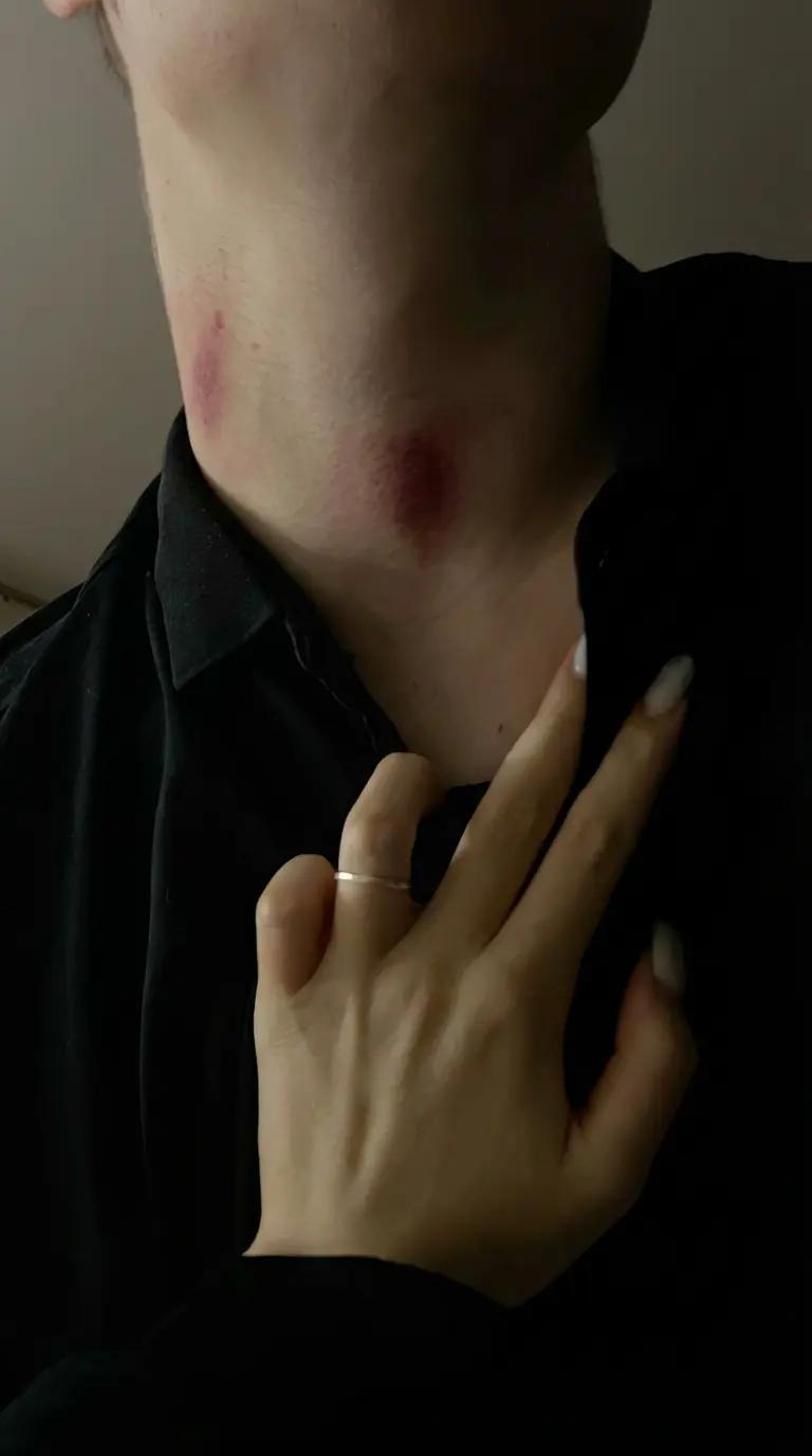 Kallias thumbnail