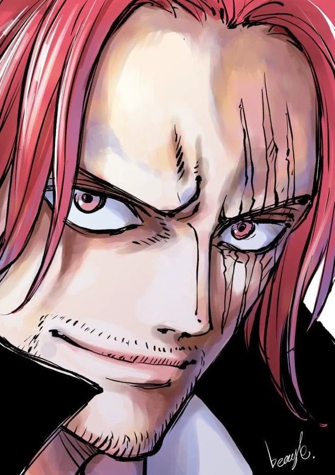 Shanks thumbnail