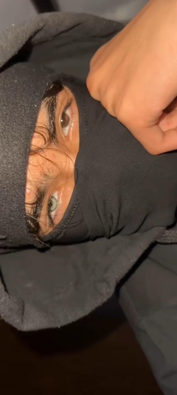 Iridum heterochromia💚✨ thumbnail