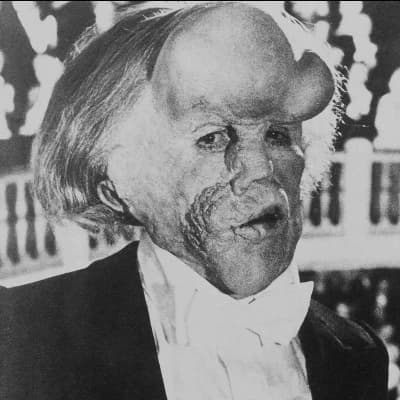 Joseph Merrick/The Elephant man thumbnail