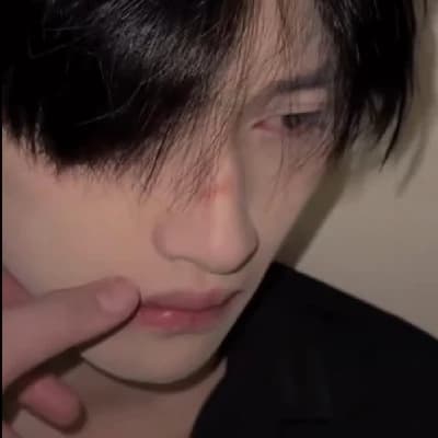 Yim. thumbnail